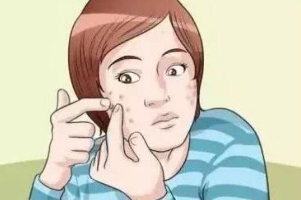 青春痘有哪幾種類型 青春痘有膿包怎么辦 青春痘有哪幾種類型 青春痘有膿包怎么辦