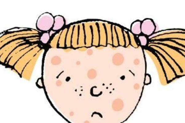 青春痘有哪幾種類型 青春痘有膿包怎么辦 青春痘有哪幾種類型 青春痘有膿包怎么辦