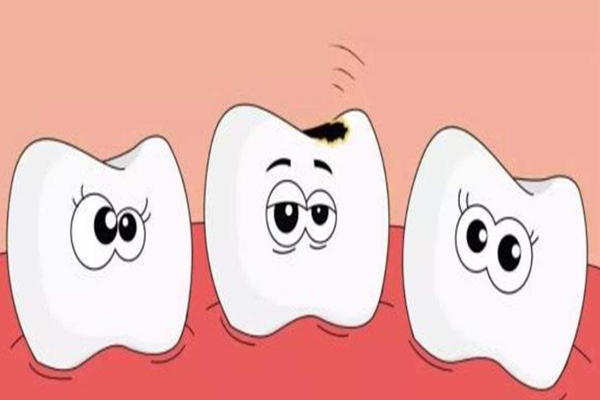 補(bǔ)牙是越貴越好嗎 補(bǔ)牙最好的方式