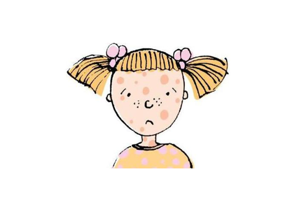 黃褐斑可以自己淡掉嗎 黃褐斑可以做光子嫩膚嗎 黃褐斑可以自己淡掉嗎 黃褐斑可以做光子嫩膚嗎