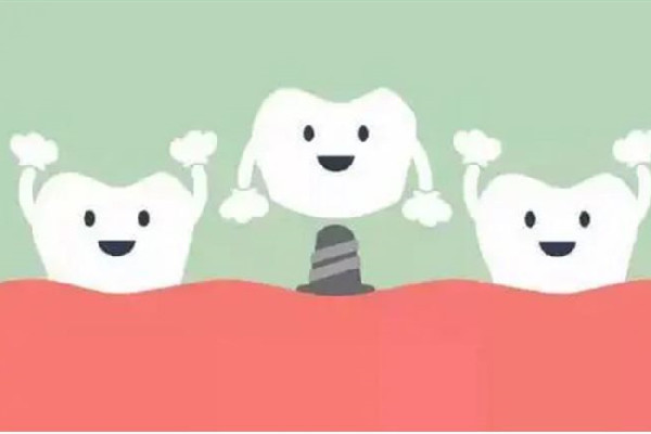 種牙去醫(yī)院還是口腔診所 種牙去私立好還是公立好 種牙去醫(yī)院還是口腔診所 種牙去私立好還是公立好