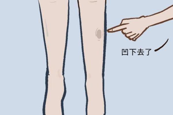 水腫是什么意思 過(guò)敏性水腫癥狀有哪些