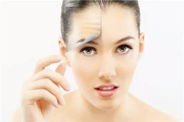 抬頭紋是怎樣形成的 抬頭紋可以去除嗎 抬頭紋是怎樣形成的 抬頭紋可以去除嗎