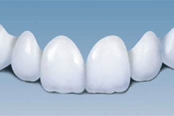 烤瓷牙有縫隙怎么修補(bǔ) 烤瓷牙出現(xiàn)黑線(xiàn)要換嗎