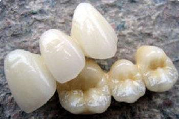 烤瓷牙有縫隙怎么修補(bǔ) 烤瓷牙出現(xiàn)黑線(xiàn)要換嗎