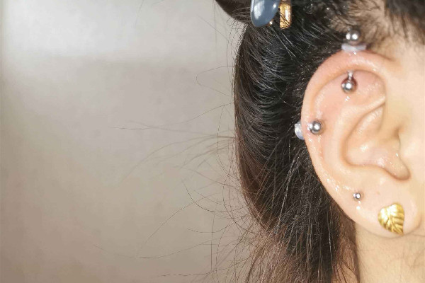 打耳骨后面長了個肉坨坨怎么處理 打耳骨有什么風險 打耳骨后面長了個肉坨坨怎么處理 打耳骨有什么風險