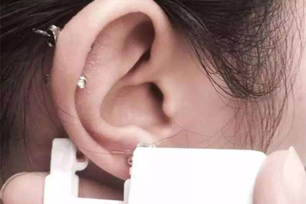 打耳骨需要去醫(yī)院?jiǎn)?打耳骨去哪打比較安全 打耳骨需要去醫(yī)院?jiǎn)?打耳骨去哪打比較安全