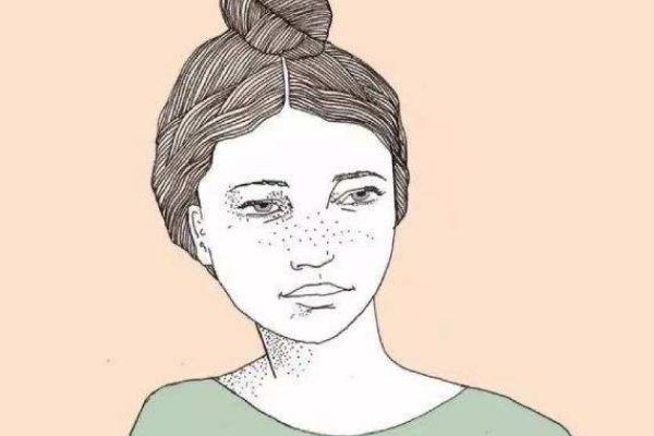 皮秒祛斑可以維持多久不長斑 皮秒祛斑可以洗臉嗎 皮秒祛斑可以維持多久不長斑 皮秒祛斑可以洗臉嗎