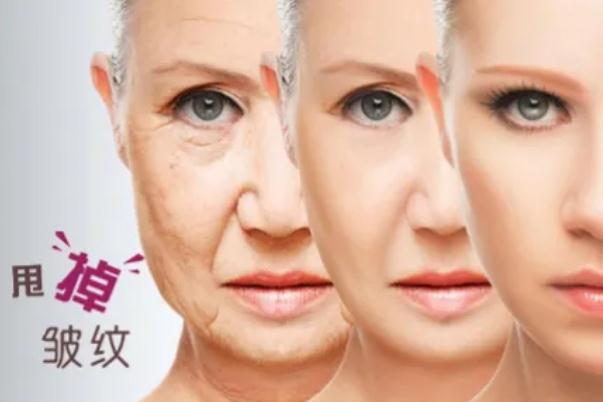 肉毒素除皺的副作用有多厲害 肉毒素除皺幾天有效果 肉毒素除皺的副作用有多厲害 肉毒素除皺幾天有效果