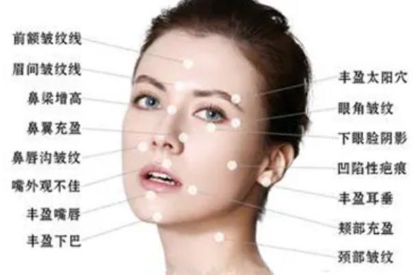 肉毒素除皺的注意事項 肉毒素除皺是永久的嗎 肉毒素除皺的注意事項 肉毒素除皺是永久的嗎