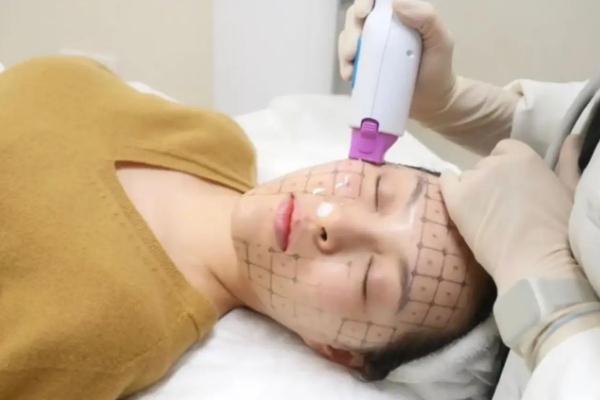 熱瑪吉是什么原理 熱瑪吉是什么美容項目 熱瑪吉是什么原理 熱瑪吉是什么美容項目