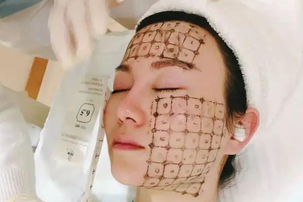 熱瑪吉對法令紋效果怎么樣 熱瑪吉對懷孕有影響嗎 熱瑪吉對法令紋效果怎么樣 熱瑪吉對懷孕有影響嗎