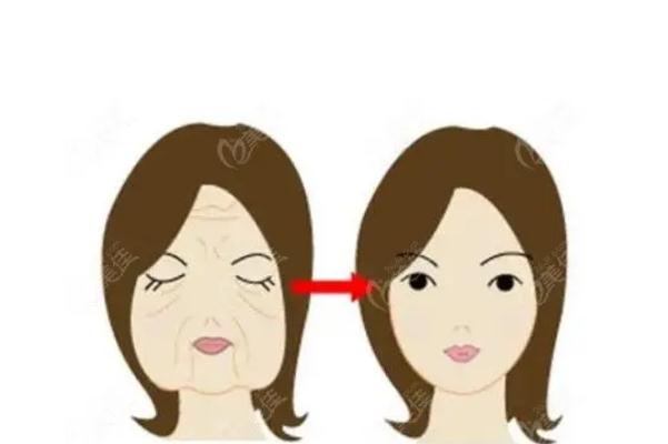 拉皮手術(shù)有后遺癥嗎 拉皮手術(shù)有風(fēng)險嗎 拉皮手術(shù)有后遺癥嗎 拉皮手術(shù)有風(fēng)險嗎