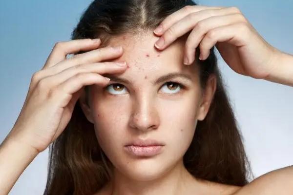 紅藍光祛痘的作用及副作用 紅藍光祛痘到底有沒有效果 紅藍光祛痘的作用及副作用 紅藍光祛痘到底有沒有效果