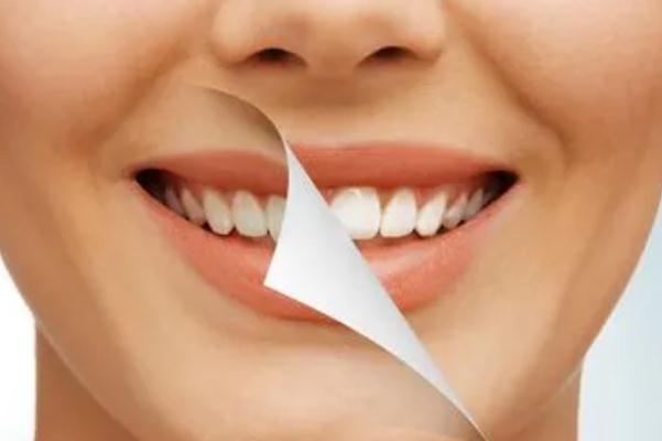 冷光美白牙齒要做幾次 牙齒冷光美白的機理 冷光美白牙齒要做幾次 牙齒冷光美白的機理