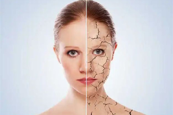 膠原蛋白填充后為什么越來越腫 膠原蛋白填充多久恢復(fù)自然