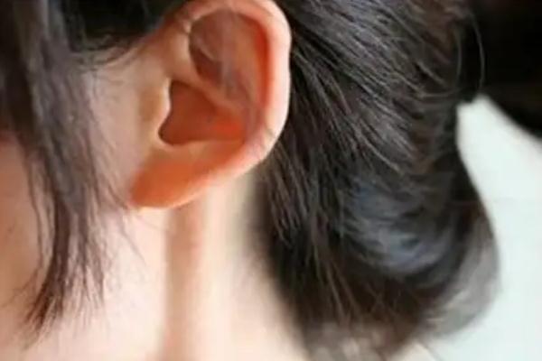 豐耳垂最好的方法 豐耳垂是永久的嗎 豐耳垂最好的方法 豐耳垂是永久的嗎