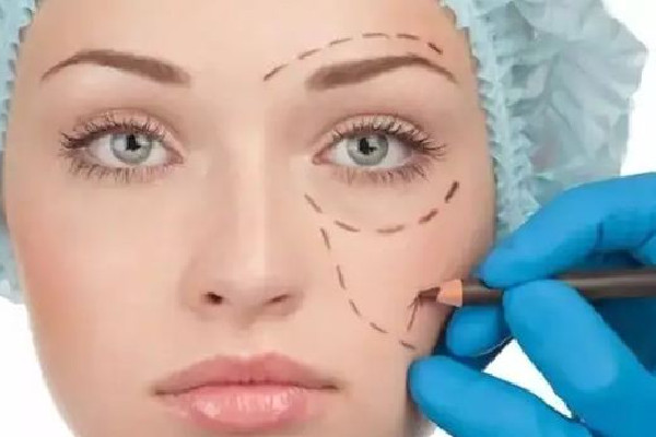 淚溝填充可以維持多久 淚溝填充多久才能恢復自然