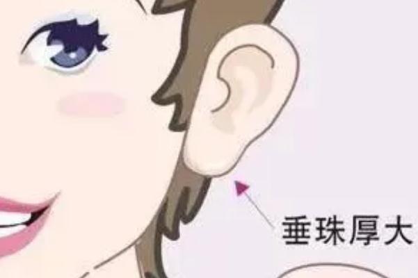 豐耳垂最好的方法 豐耳垂是永久的嗎 豐耳垂最好的方法 豐耳垂是永久的嗎
