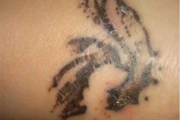 洗紋身一般要洗幾次才能干凈 洗紋身可以完全洗掉嗎 洗紋身一般要洗幾次才能干凈 洗紋身可以完全洗掉嗎