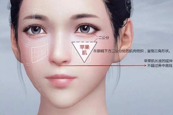 蘋果肌復(fù)位術(shù)怎么做 蘋果肌復(fù)位術(shù)可以保持多久