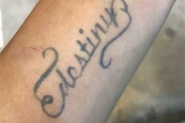 洗紋身會(huì)有增生疤痕嗎 洗紋身有點(diǎn)凸起來正常嗎 洗紋身會(huì)有增生疤痕嗎 洗紋身有點(diǎn)凸起來正常嗎