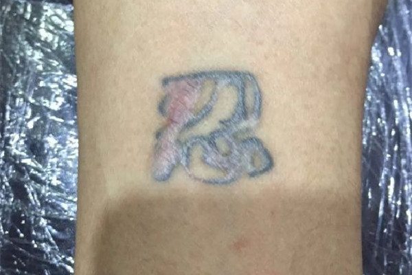 洗紋身后留疤怎么去除 洗紋身后怎樣保養(yǎng)才不留疤 洗紋身后留疤怎么去除 洗紋身后怎樣保養(yǎng)才不留疤