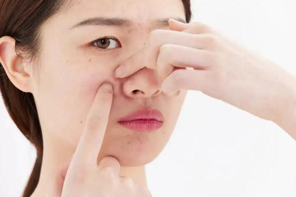 皮膚出油要用洗面奶嗎 皮膚出油要一直吃異維A酸嗎 皮膚出油要用洗面奶嗎 皮膚出油要一直吃異維A酸嗎