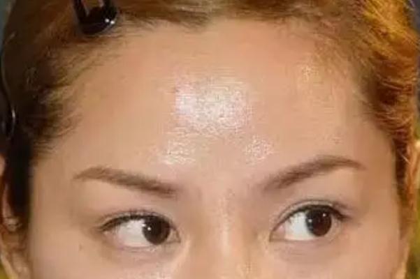 皮膚出油可以直接用散粉嗎 皮膚出油可以吃維生素B6調理嗎 皮膚出油可以直接用散粉嗎 皮膚出油可以吃維生素B6調理嗎