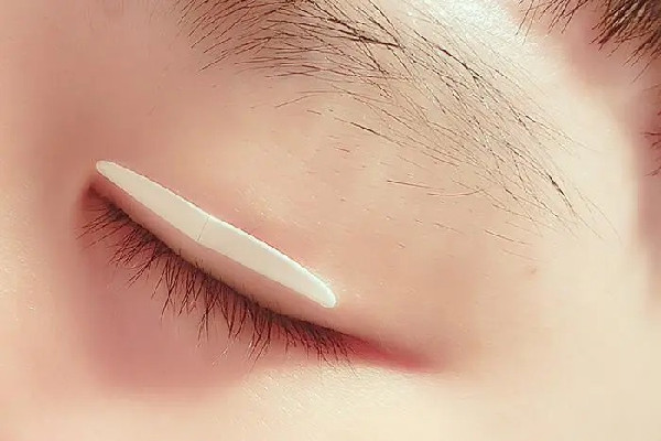 雙眼皮貼直接撕會怎樣 雙眼皮貼怎么取下來 雙眼皮貼直接撕會怎樣 雙眼皮貼怎么取下來