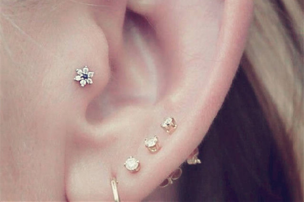 打耳洞增生疙瘩怎么辦 打耳洞為什么會(huì)長(zhǎng)疙瘩 打耳洞增生疙瘩怎么辦 打耳洞為什么會(huì)長(zhǎng)疙瘩