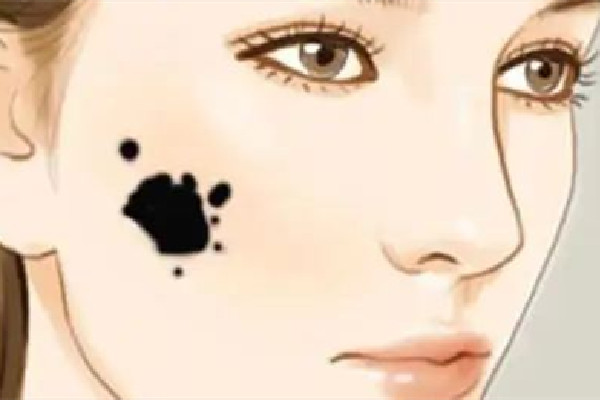 武漢去胎記哪個(gè)醫(yī)院最好 武漢去胎記醫(yī)院排名 武漢去胎記哪個(gè)醫(yī)院最好 武漢去胎記醫(yī)院排名