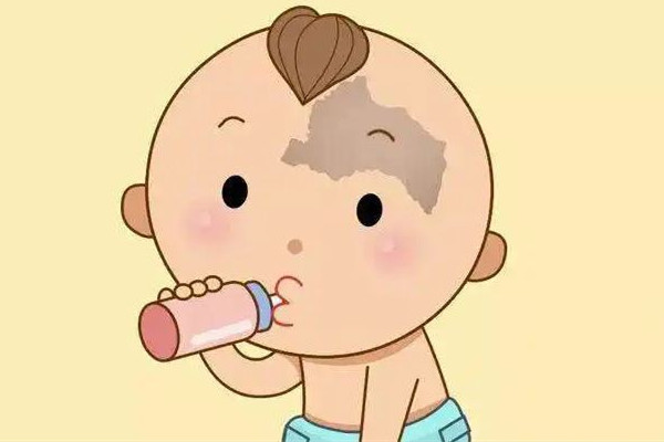 武漢去胎記哪個(gè)醫(yī)院最好 武漢去胎記醫(yī)院排名 武漢去胎記哪個(gè)醫(yī)院最好 武漢去胎記醫(yī)院排名