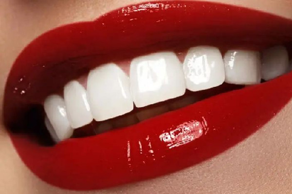 武漢美白牙齒去哪里好 武漢美白牙齒多少錢(qián)