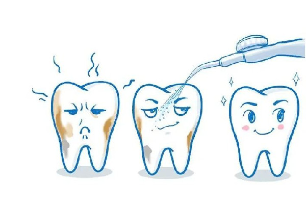 武漢洗牙較好的醫(yī)院 武漢洗牙一次大概多少錢(qián) 武漢洗牙較好的醫(yī)院 武漢洗牙一次大概多少錢(qián)