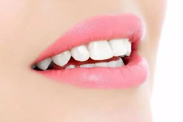 武漢美白牙齒去哪里好 武漢美白牙齒多少錢(qián)