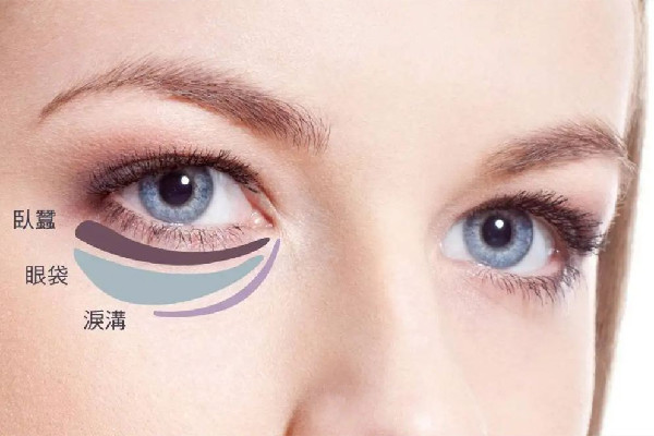 武漢激光去眼袋價(jià)格 武漢激光去眼袋哪家好 武漢激光去眼袋價(jià)格 武漢激光去眼袋哪家好