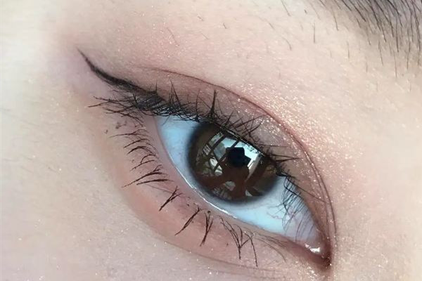 武漢豐臥蠶哪家醫(yī)院好 武漢做臥蠶大概多少錢