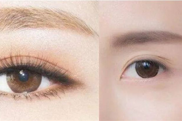 武漢眉骨修復(fù)哪里好 武漢眉骨修復(fù)多少錢(qián)