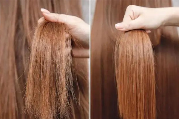 干性頭發(fā)會變成油性頭發(fā)嗎 干性頭發(fā)會導致頭皮屑嗎