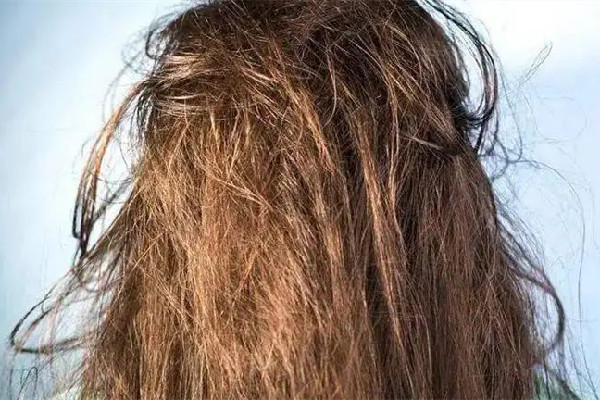 干性頭發(fā)怎么護(hù)理 干性頭發(fā)用有硅油的好一點(diǎn)還是用無(wú)硅油好