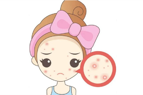 光谷天地傾顏皮膚管理中心痘痘肌護(hù)理效果怎么樣 痘痘肌多久可以改善過來(lái)