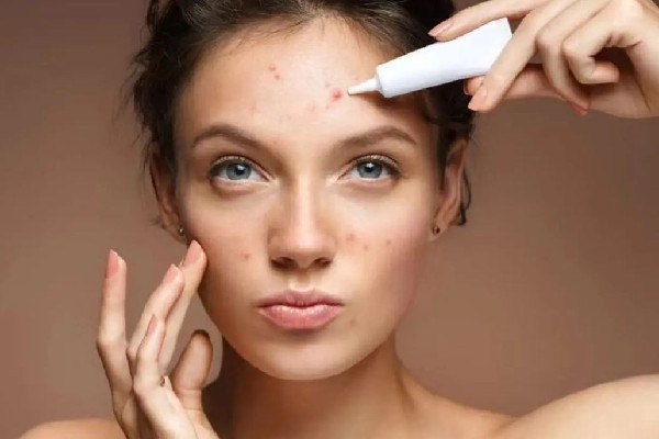 積玉橋俏佳人美容形象會所痘痘肌清理怎么樣 痘痘肌膚適合用什么洗面奶 積玉橋俏佳人美容形象會所痘痘肌清理怎么樣 痘痘肌膚適合用什么洗面奶