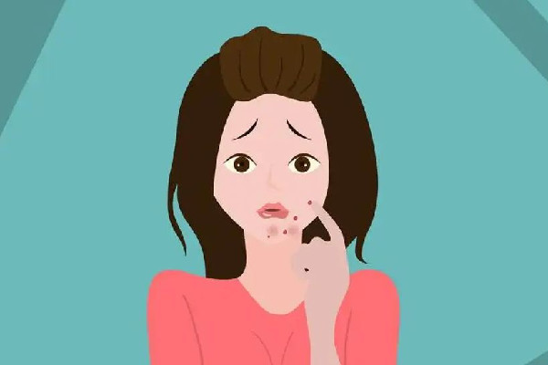 中南路漾膚皮膚管理店痘肌護(hù)理項目怎么樣 痘痘肌護(hù)理注意事項