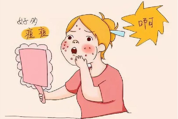 中南路蕾特恩專(zhuān)業(yè)祛痘·面部皮膚管理店痘痘肌護(hù)理好嗎 痘痘肌要一輩子忌口嗎