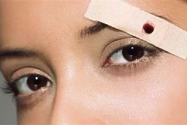 中南路美涵·半永久美睫美膚館洗眼線效果怎么樣 洗眼線是激光好還是皮秒好 中南路美涵·半永久美睫美膚館洗眼線效果怎么樣 洗眼線是激光好還是皮秒好