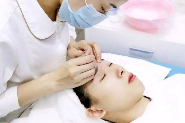 后湖SOR索爾祛痘?面部肌膚科學(xué)管理針清效果怎么樣 針清會(huì)讓毛孔變大嗎