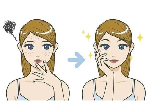 后湖炫麗科技美膚????Better Skin祛痘痘干凈嗎 祛痘用什么產(chǎn)品好 后湖炫麗科技美膚????Better Skin祛痘痘干凈嗎 祛痘用什么產(chǎn)品好