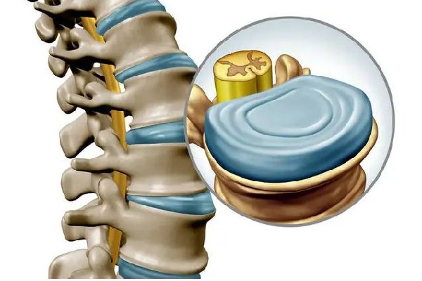 女孩染怪病后腰長出濃密毛發(fā) 脊髓發(fā)育畸形包括哪些 女孩染怪病后腰長出濃密毛發(fā) 脊髓發(fā)育畸形包括哪些