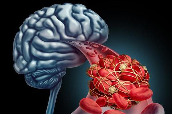 75歲老人中風(fēng)好友發(fā)現(xiàn)步數(shù)為0報警 老年人中風(fēng)要注意什么 75歲老人中風(fēng)好友發(fā)現(xiàn)步數(shù)為0報警 老年人中風(fēng)要注意什么